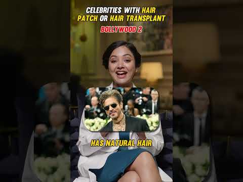 Hair Patch or Transplant? Here's what Celebs chose ? PART 2 🧐