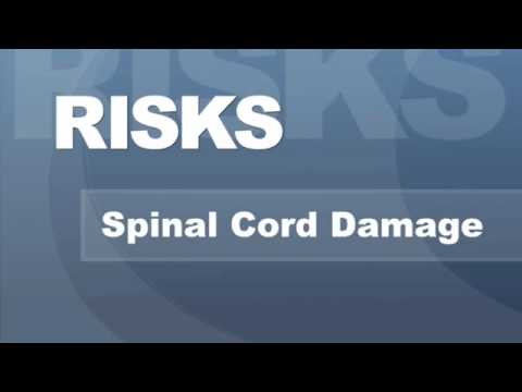 Neck Pain - Potential Risks Surgery