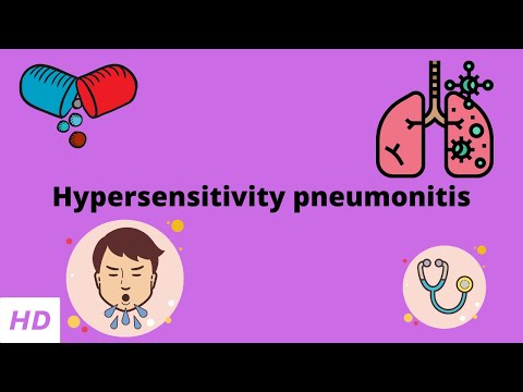 Nasal and Paranasal Tumors Causes Signs and Symptoms Diagnosis and Treatment