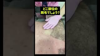 - これしてたらやばいです!ブラジリアンワックス脱毛