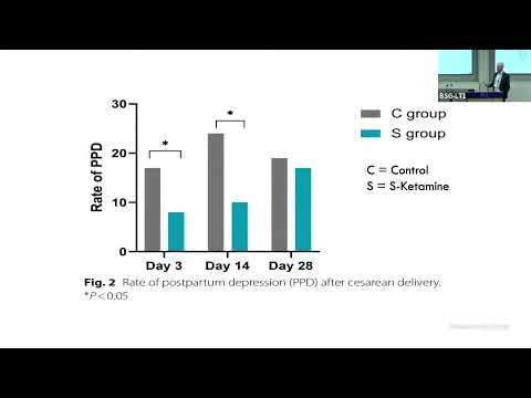 David Monks - Ketamine to prevent postpartum depression after planned cesarean delivery under...