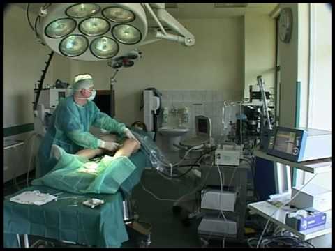 Endovenöse Laserokklusion (EVLO) mit Venex von KLS Martin (Teil 1)