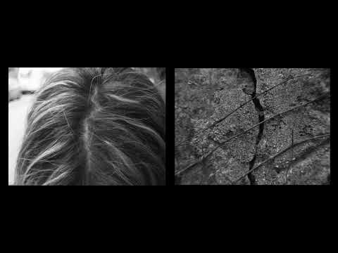 Δέρμα Πόλης/Πόλης Δέρμα