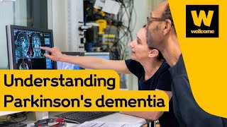 Why neuroimaging could hold the key to treating Parkinson's dementia | Wellcome