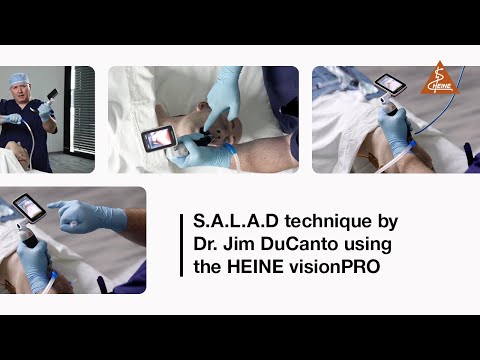 S.A.L.A.D. intubation technique by Dr. Jim Du Canto