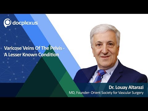 Varicose Veins Of The Pelvis- A Lesser Known Condition