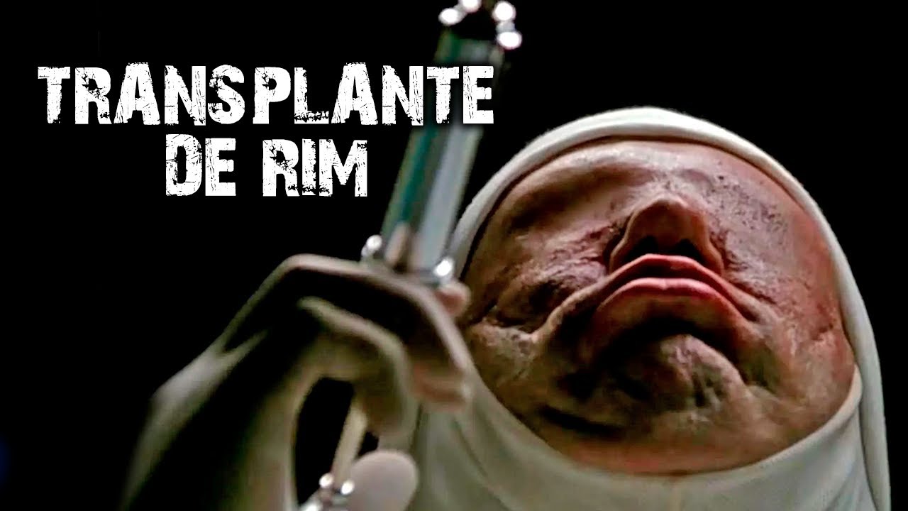 TRANSPLANTE DE RIM