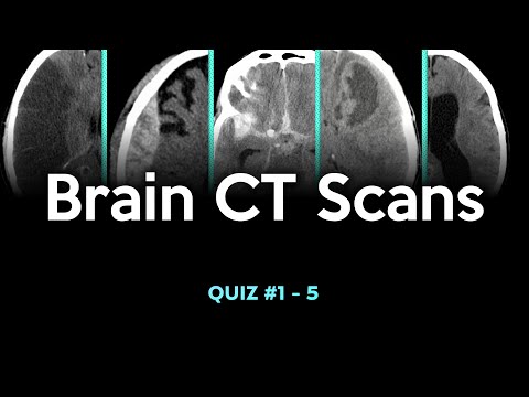 Brain CT Scans: Quiz #1 - 5