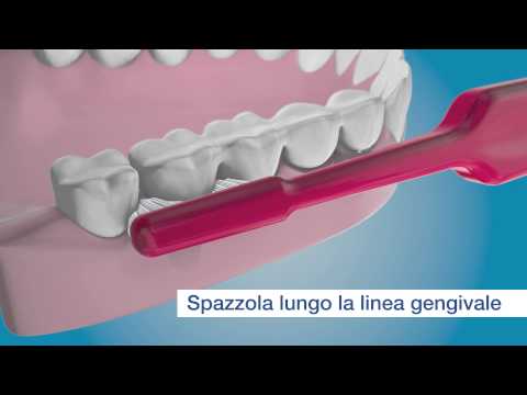 Pulisci 'ésterno dei tuoi impianti con TePe Implant Brush