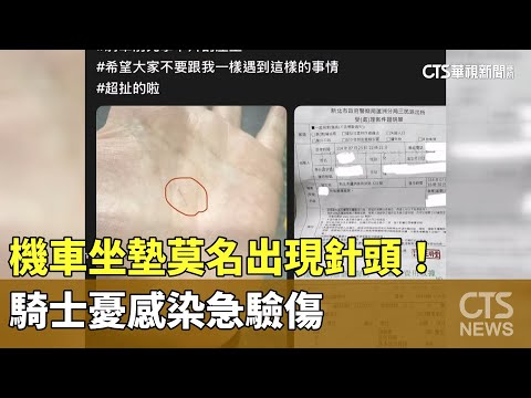 痛痛的？　機車坐墊莫名出現針頭！　騎士憂感染急驗傷