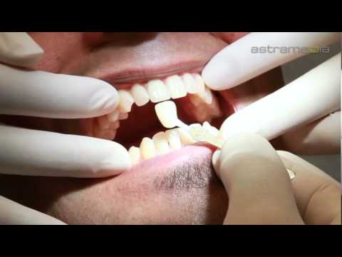 download lagu mp3 mp4 Zahnarzt Zug Baarerstrasse, download lagu Zahnarzt Zug Baarerstrasse gratis, unduh video klip Zahnarzt Zug Baarerstrasse