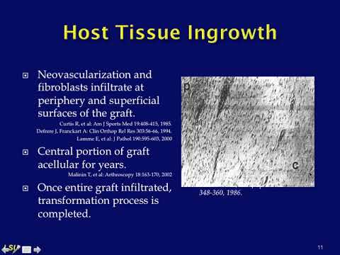 Graft Materials in Lower Urinary Tract Reconstruction