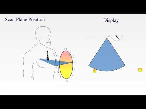 TEE Imaging Planes and Orientation