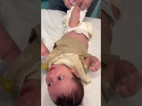 Fourth cast is on! #clubfootbaby #clubfoot #clubfeet #newborn #clubfootjourney