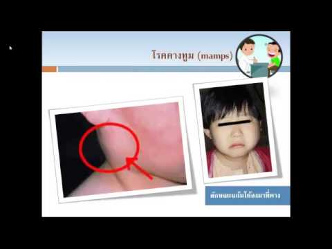 Vasodilators และความแข็งแรง โลโก้ค้อนของ ธ อร์