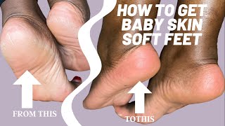 HOW TO GO FROM DRY ROUGH FEET TO BABY SKIN SOFT FEET ON THE CHEAP
