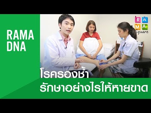 อาการ