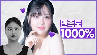 수술 후 만족도 1000% ㅣ성형비포에프터 ㅣ 뷰티라인성형외과