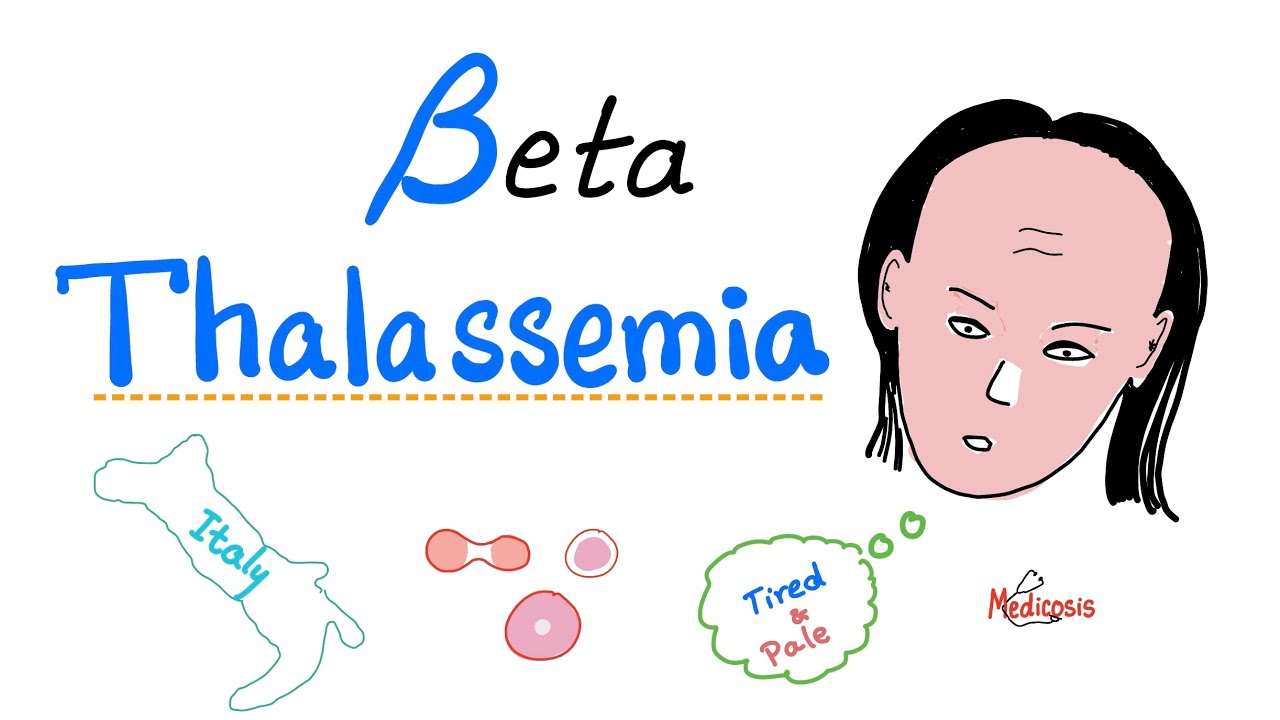 Beta Thalassemia - Causes and Types - minor, Major & Intermedia - Hematology