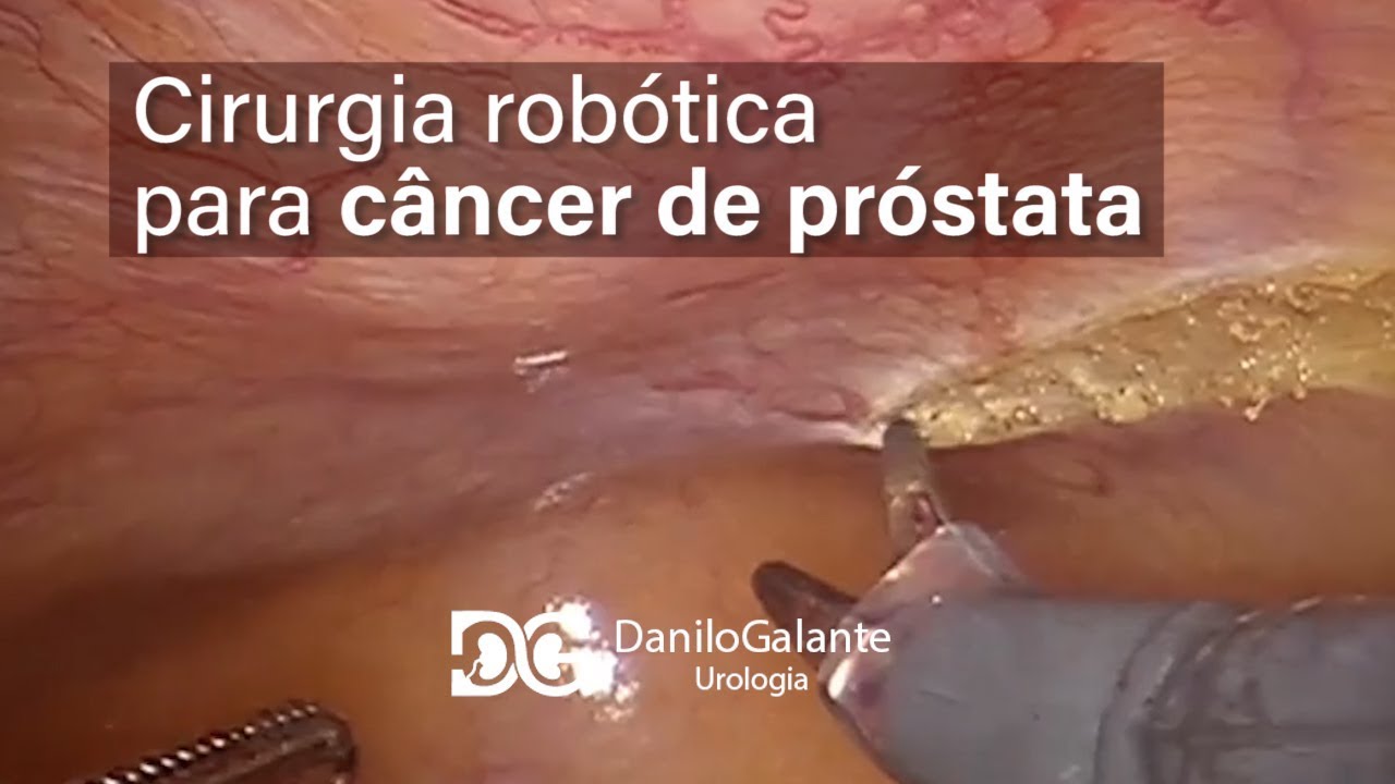 Danilo Galante Moreno-42