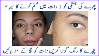 How to Get Rid off from Dry Patches on Face Skin || Dry skin Formula