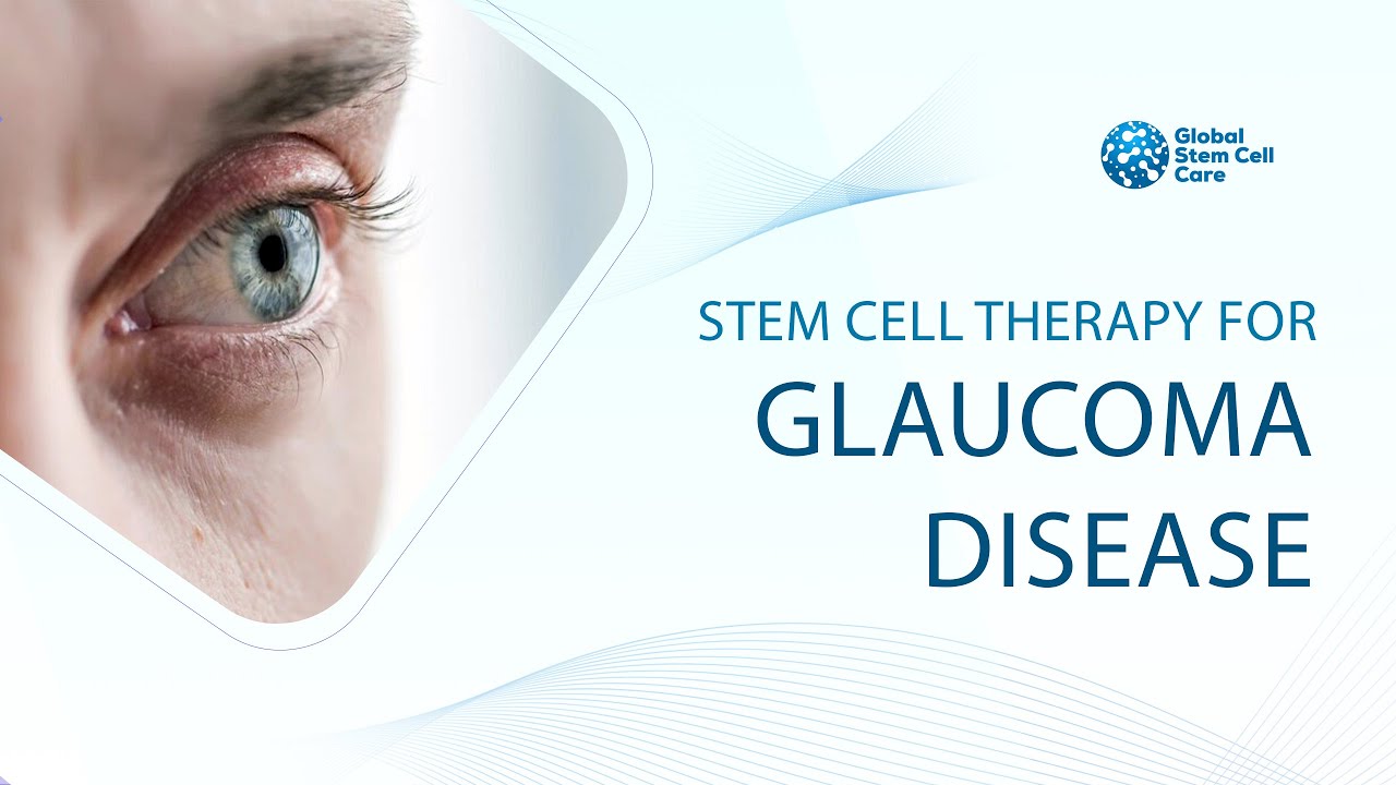 Glaucoma Eye Disease Treatment | Best Glaucoma Treatment | Stem Cell-Based Therapy for Glaucoma