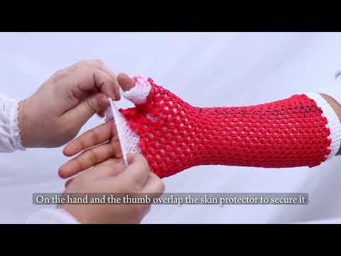 Below Elbow Cast