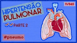Hipertensão Pulmonar (Parte 2) | PNEUMOLOGIA | 11/365
