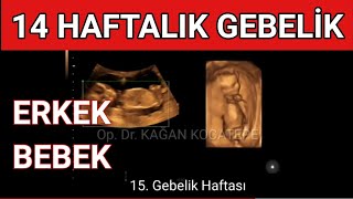 14 haftalık erkek bebek ultrasonda nasıl görün