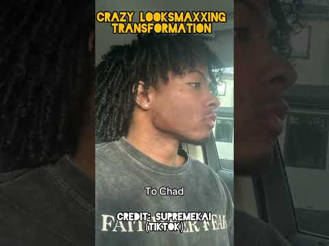 Crazy Natural & Surgical Looksmaxxing Transformation #huntereyes #jawexercises #mewing #lookmaxxing