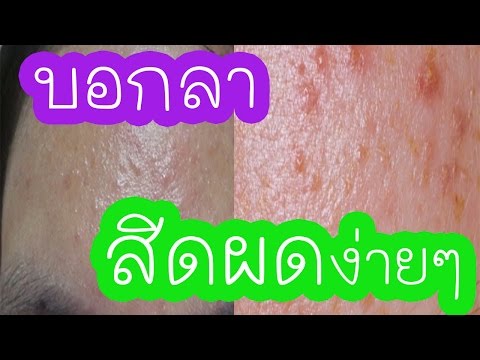 ยาโสมแรง คลินิกเซนต์ปีเตอร์สเบิร์กเพื่อเพิ่มสมาชิก