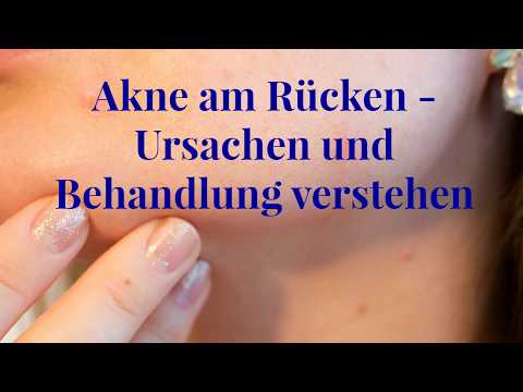 Schmerzen im Rücken gibt in Kaviar Creme Gelenke PS kaufen in Minsk
