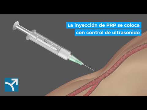 Terapia combinada de tracción y PRP para la enfermedad de Peyronie