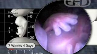 Hope for Unplanned Pregnancy: "Carrie" by Rosanne Cash