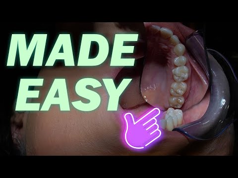 Dental Photography Techniques | Canon Nikon Sony | ULTIMATE GUIDE | Part 3