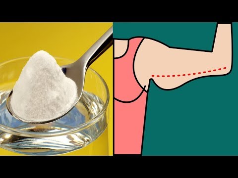 Kung paano mapupuksa ang mga gilid ng mga batang babae sa bahay Kung ito ay posible upang bigyan ng kapanganakan sa sobra sa timbang
