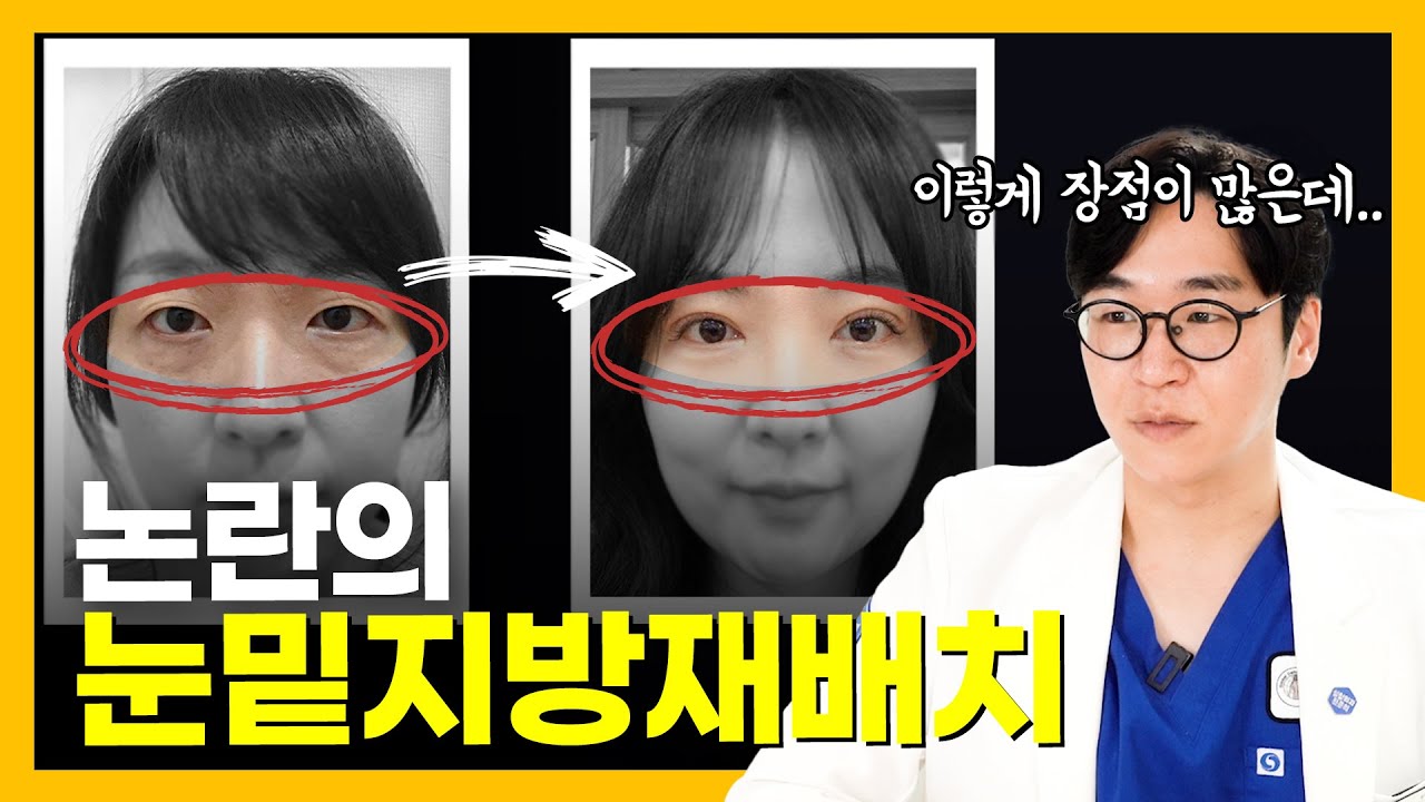 눈밑지방재배치 vs 하안검