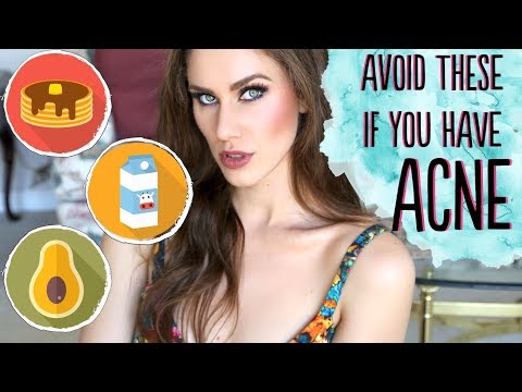 download lagu mp3 mp4 Does Avocado Cause Acne, download lagu Does Avocado Cause Acne gratis, unduh video klip Does Avocado Cause Acne