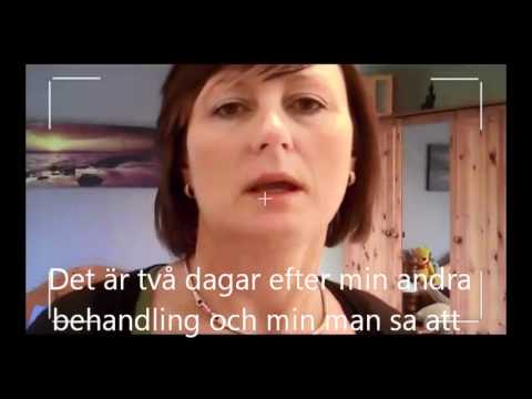 Hur man blir av med Pigmentfläckar Del 1 av 2