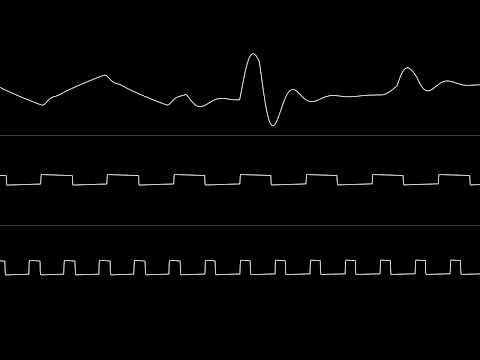Stinsen - “Whiteout” (C64) [Oscilloscope View]