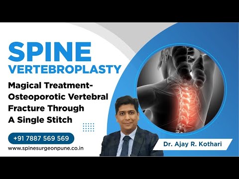 Patient Testimonials | Dr. Ajay Kothari - Spine Surgeon | Shivaji Nagar, Pune