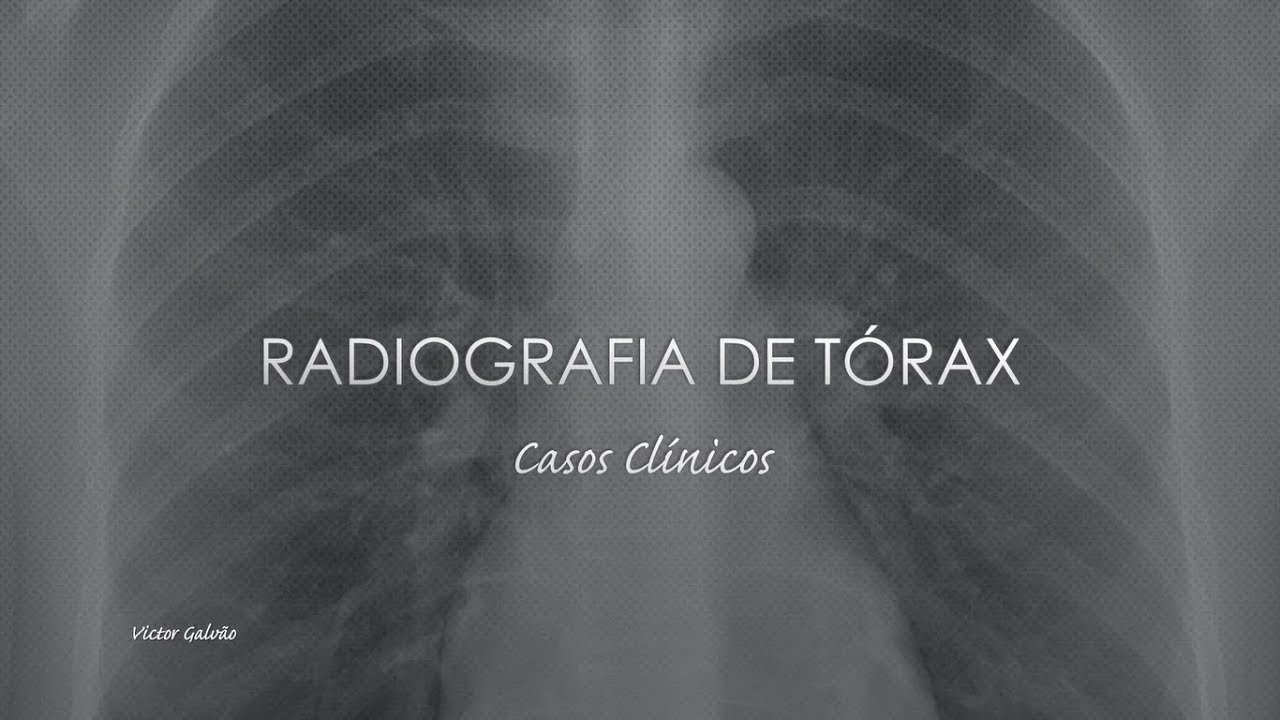 Chest X-ray (Clinical Cases)