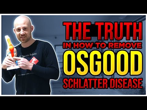 What is Osgood Schlatter's disease? How do we diagnose and TREAT it?