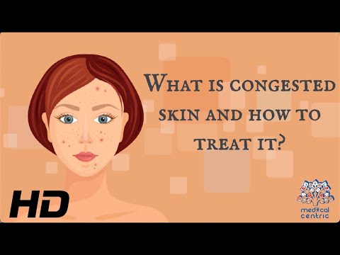 All About Allergy Shots