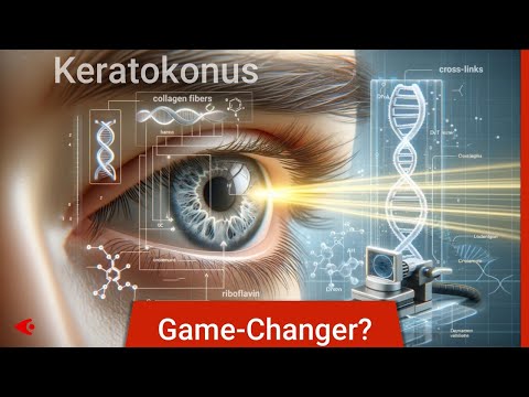 Cross Linking bei Keratokonus: Ein Game-Changer?
