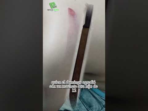 Un hombre de 59 años fue detenido en Oberá, acusado de agredir con un machete a su hijastro