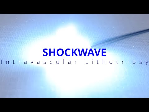 How to Prep and Use Shockwave Intravascular Lithotripsy