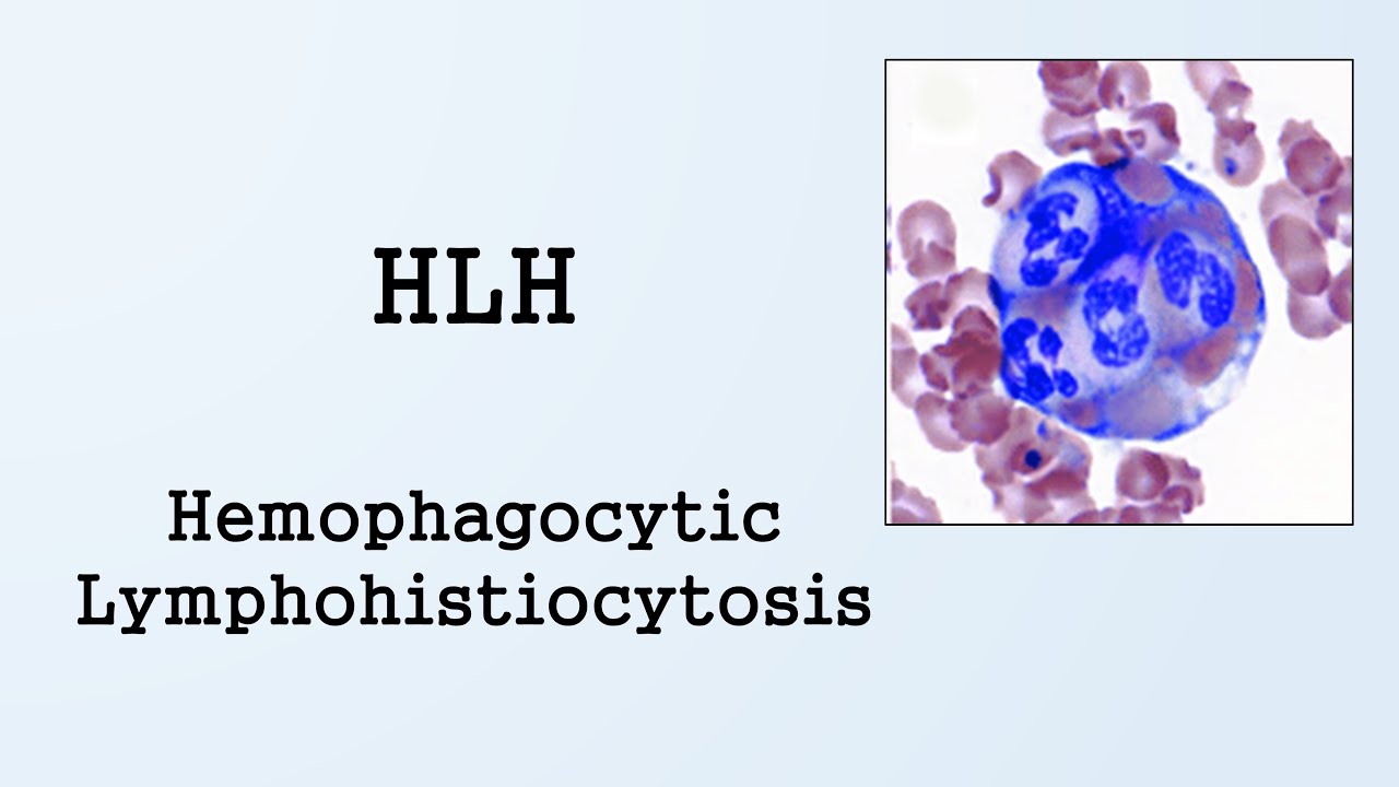 Hemophagocytic Lymphohistiocytosis (HLH)