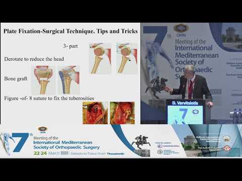 Varvitsiotis D - Plate fixation-Surgical technique. Tips and tricks