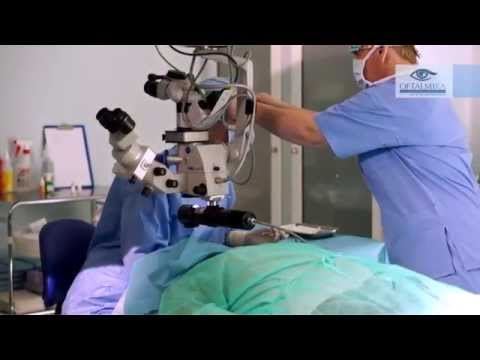 Stożek rogówki. Opinie na temat zabiegu cross-linkingu- www.oftalmika.pl